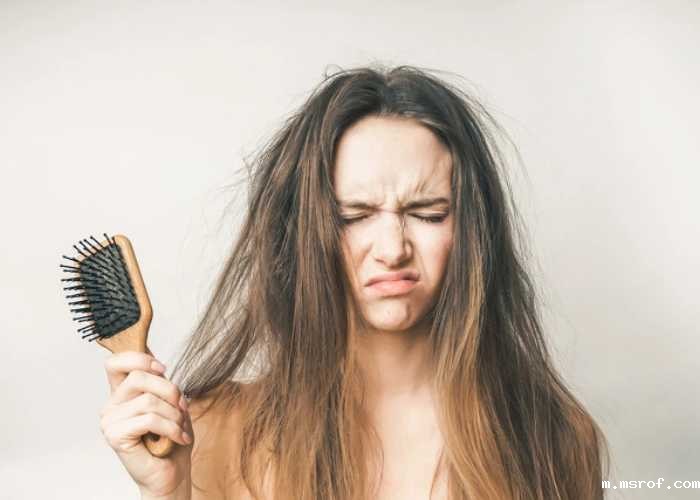 开云体育新人生物 头发脱发严重